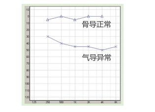 传导性听损的解决办法