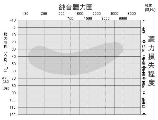 三分钟教您看懂听力测试结果-听力图
